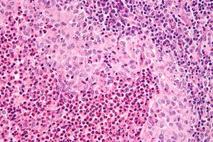 Las células de Langerhans son células dendríticas no linfoides, que se localizan en la piel y cumplen una función antigénica, 1