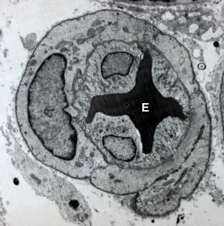 Morfología de las células endoteliales